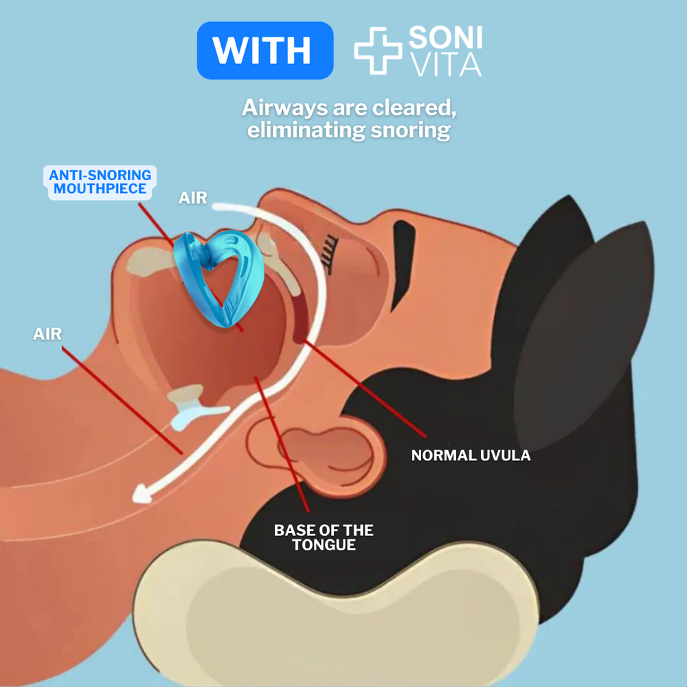 SoniVita - Anti-Snoring Mouthpiece Universal Size image SoniVita - Anti-Snoring Mouthpiece Universal Size