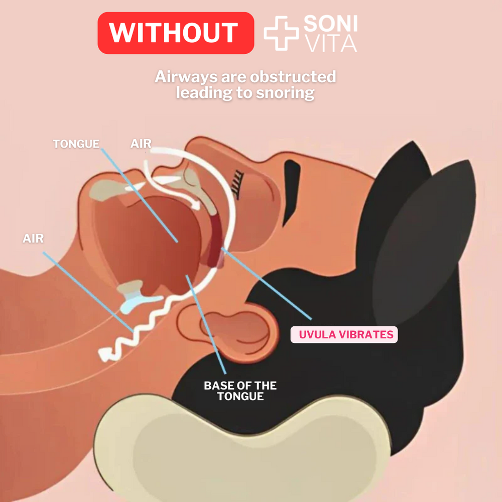 SoniVita - Anti-Snoring Mouthpiece Universal Size image SoniVita - Anti-Snoring Mouthpiece Universal Size